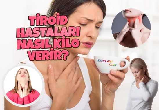 Tiroid Hastaları Nasıl Kilo Verir?
